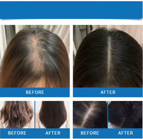 Hair Regrowth Roll-On Serum